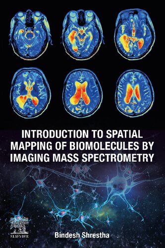 Introduction to Spatial Mapping of Biomolecules by Imaging Mass Spectrometry