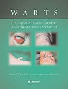 Warts : diagnosis and management : an evidence based approach
