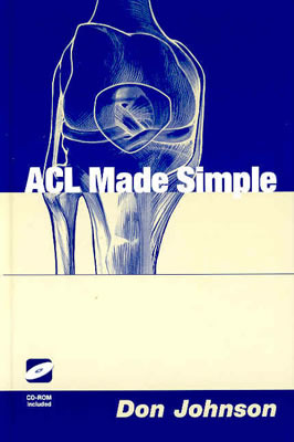 ACL Made Simple [With CDROM]