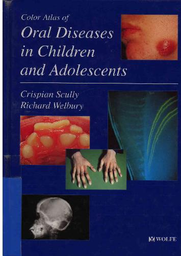 Color Atlas of Oral Diseases in Children and Adolescents