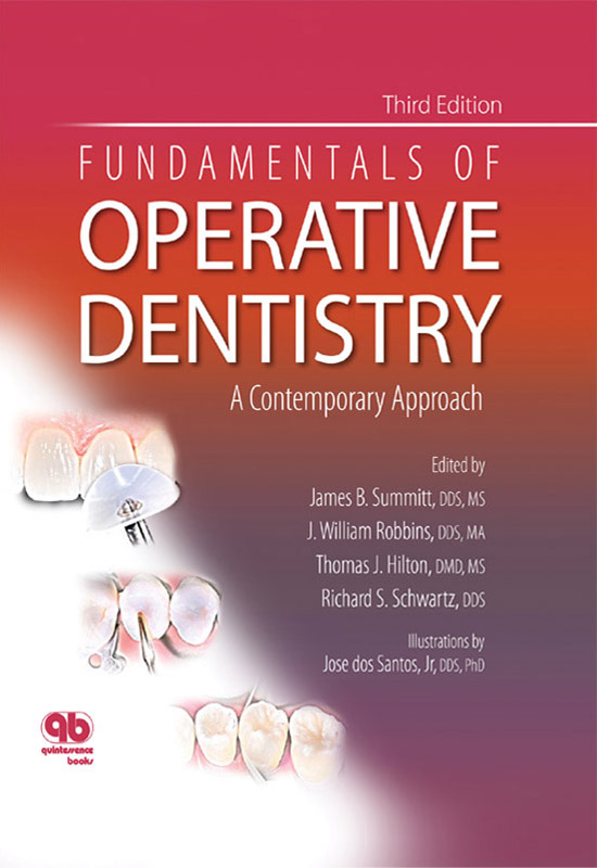 Fundamentals of Operative Denistry
