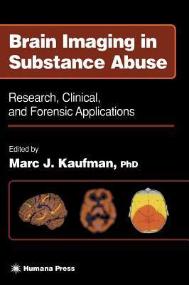 Brain Imaging in Substance Abuse