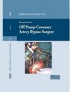 Off-Pump Coronary Artery Bypass Surgery