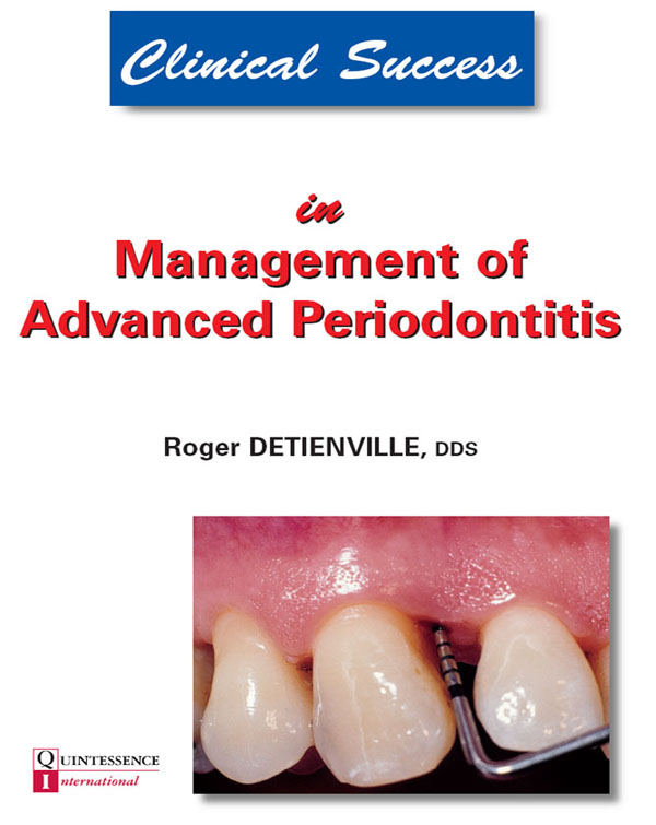 Clinical Success in Management of Advanced Periodontitis