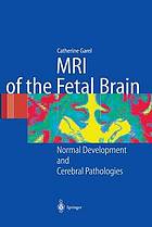 MRI of the fetal brain : normal development and cerebral pathologies