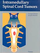 Intramedullary Spinal Cord Tumors