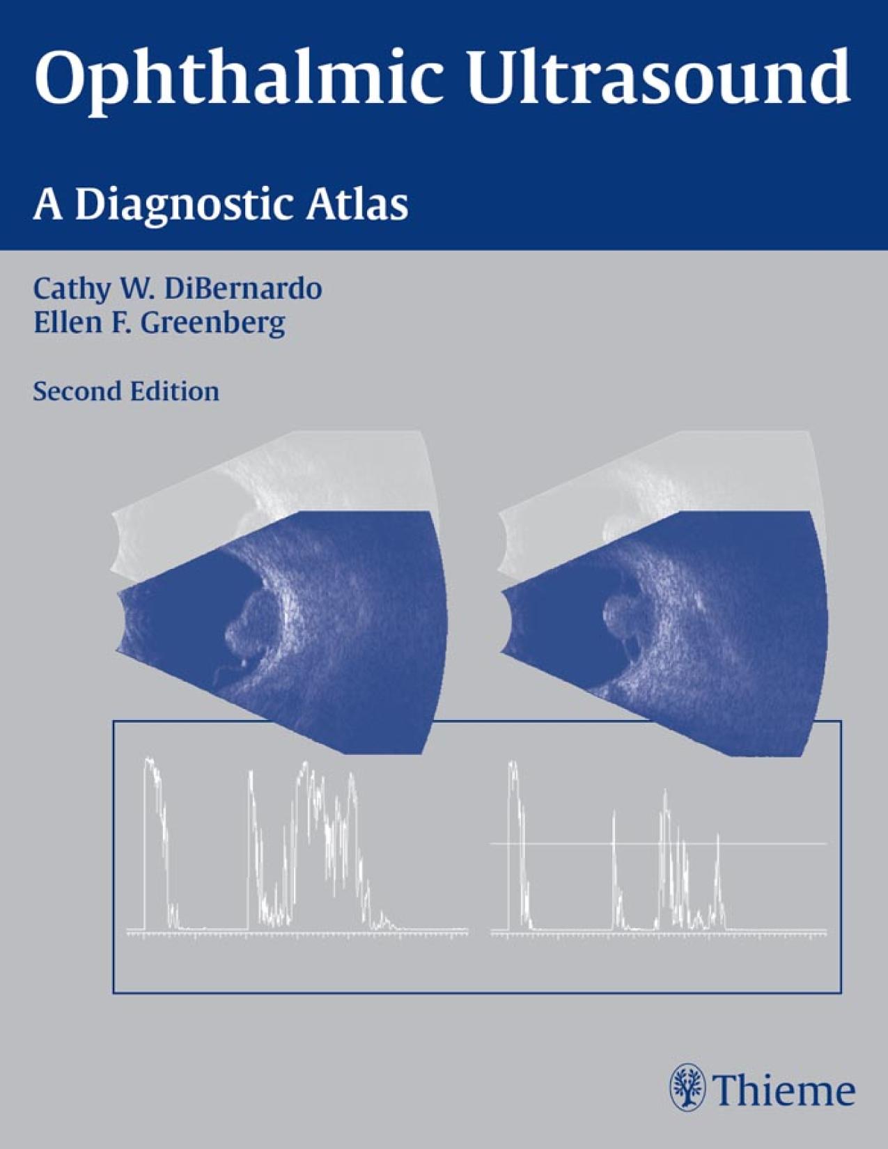 Ophthalmic Ultrasound