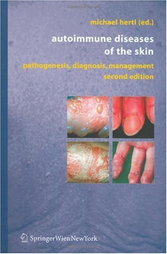 Autoimmune Diseases Of The Skin