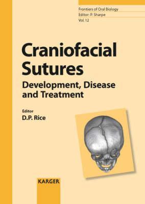 Craniofacial Sutures