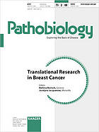 Translation research in breast cancer