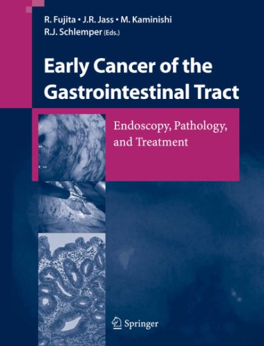 Early Cancer of the Gastrointestinal Tract