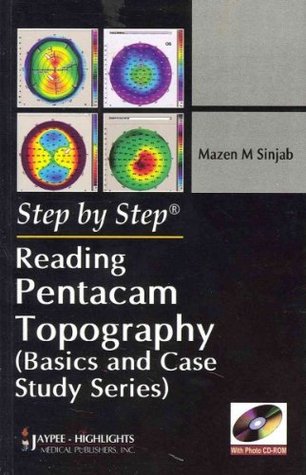 Reading Pentacam Topography (Step By Step