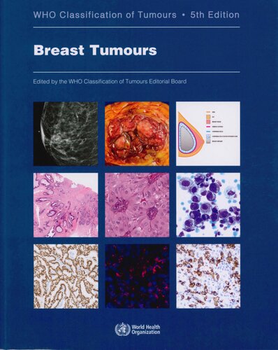 Breast Tumours