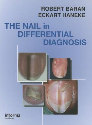Nail In Differential Diagnosis