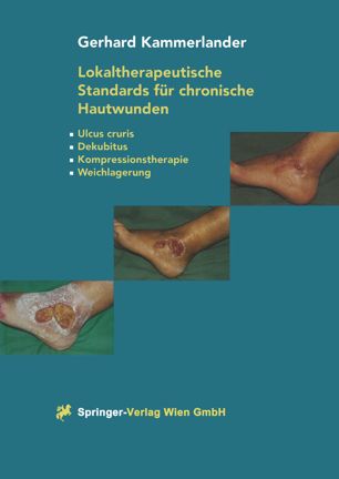 Lokaltherapeutische Standards für chronische Hautwunden : Ulcus cruris, Dekubitus, Kompressionstherapie, Weichlagerung