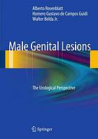 Male genital lesions : the urological perspective