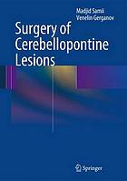 Surgery of cerebellopontine lesions