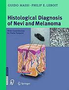 Histological diagnosis of nevi and melanoma