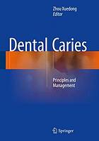 Dental caries : principles and management