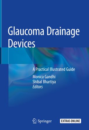 Glaucoma drainage devices : a practical illustrated guide