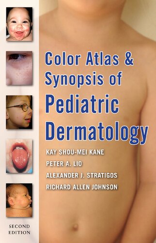 Color Atlas &amp; Synopsis of Pediatric Dermatology