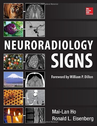 Neuroradiology Signs