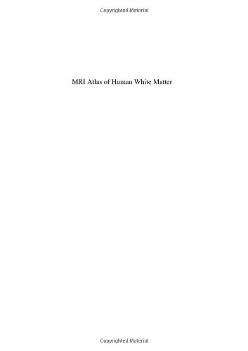 MRI Atlas of Human White Matter