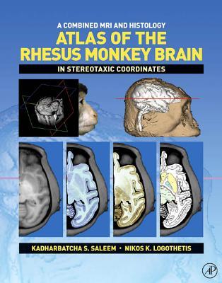 A Combined MRI and Histology Atlas of the Rhesus Monkey Brain