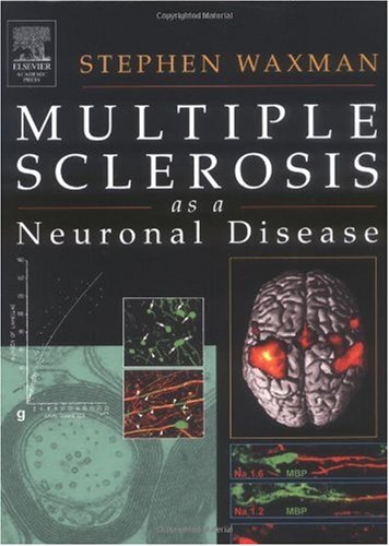 Multiple Sclerosis as a Neuronal Disease