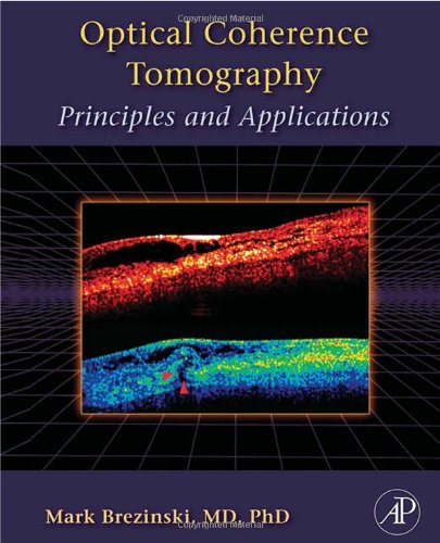 Optical Coherence Tomography