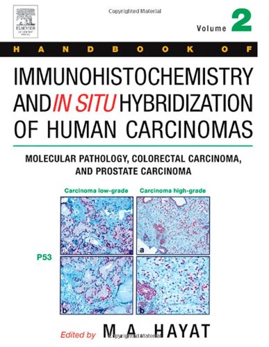 Handbook of Immunohistochemistry and in Situ Hybridization of Human Carcinomas, Volume 2