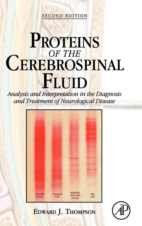 Proteins of the Cerebrospinal Fluid: Analysis &amp; Interpretation in the Diagnosis and Treatment of Neurological Disease