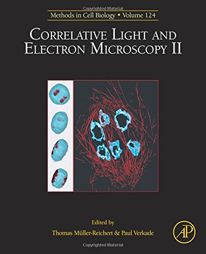 Correlative Light and Electron Microscopy II, 124