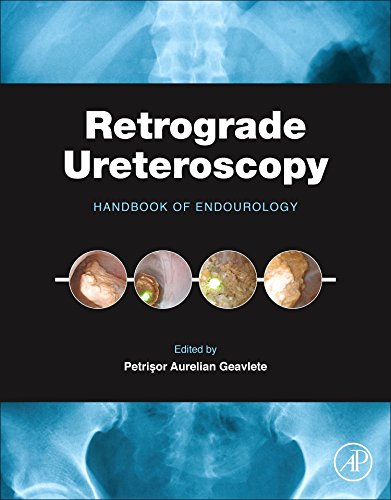 Retrograde ureteroscopy : handbook of endourology