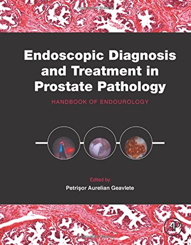 Endoscopic Diagnosis and Treatment in Prostate Pathology : Handbook of Endourology