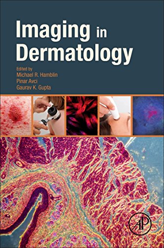 Imaging in dermatology