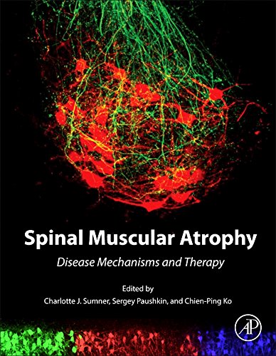 Spinal Muscular Atrophy.