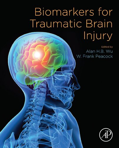 Biomarkers for Traumatic Brain Injury