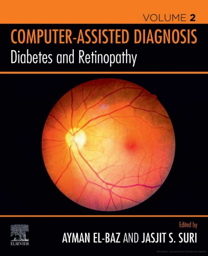 Diabetes and retinopathy