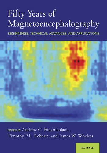 Fifty Years of Magnetoencephalography