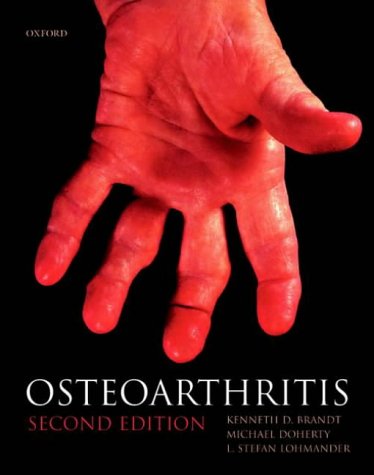 Osteoarthritis