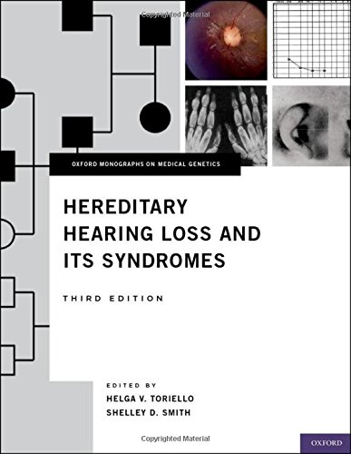 Hereditary Hearing Loss and Its Syndromes