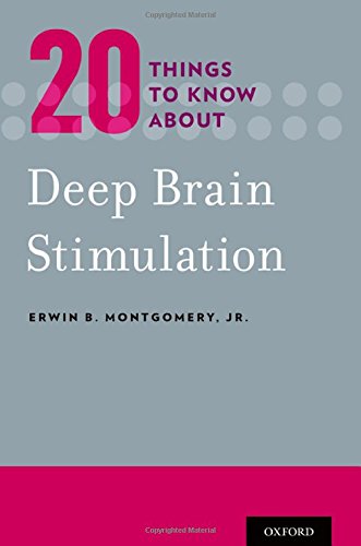 20 Things to Know about Deep Brain Stimulation