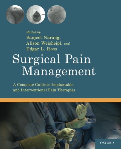 Surgical pain management : a complete guide to implantable and interventional pain therapies