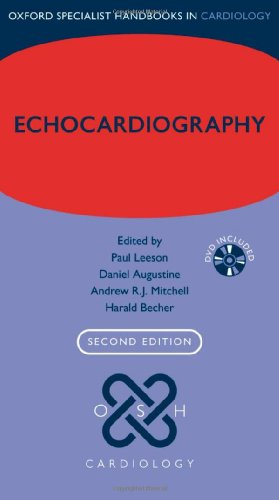 Echocardiography