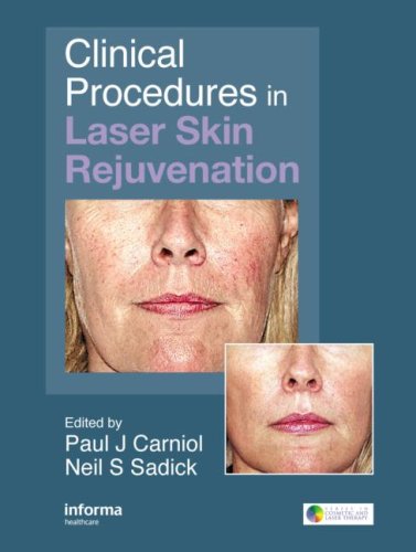 Clinical procedures in laser skin rejuvenation