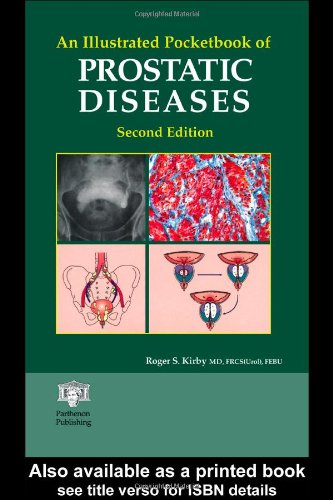 An Illustrated Pocketbook of Prostatic Disease