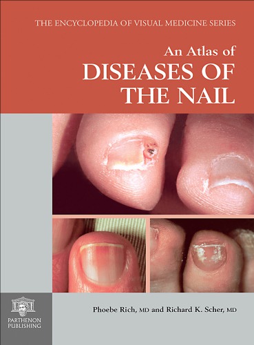 Atlas Of Diseases Of The Nail