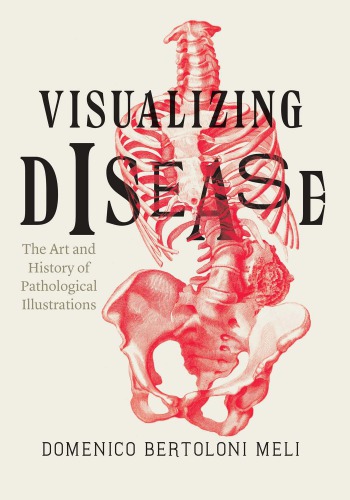 Visualizing Disease.