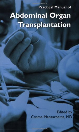 Practical Manual of Abdominal Organ Transplantation